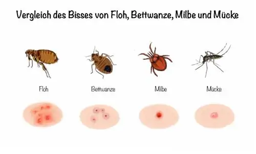 Comparação da picada de pulga, percevejo, ácaro e mosquito