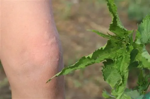 Ribwort plantain against nettle burns